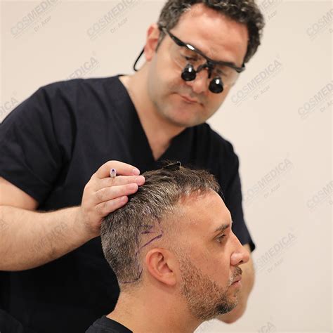 keiran lee hair transplant